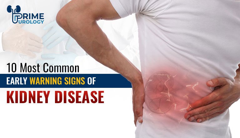 10 Early Warning Signs of Kidney Disease