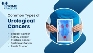 Different Types of Urological Cancers